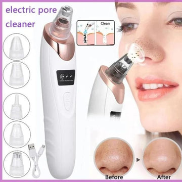 Electric Blackhead Remover Vacuum – Deep Pore Cleaner & Facial Acne Extractor